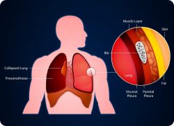 e-Xpert ABCDE: Opvang van de traumapatiënt