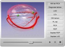 e-Xpert ECG: 3D Coronairanatomie