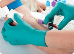 e-Xpert VBH: Bloedafname en bloedkweken