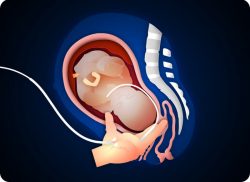 e-Xpert CTG: Inleiding