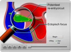 e-Xpert ECG: Klinische Elektrocardiografie (2016)