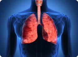 e-Xpert Venticare: Beademing