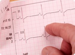 e-Xpert ECG: Inleiding in ritmestoornissen