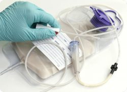 e-Xpert VBH: Sondevoeding toedienen