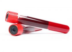 e-Xpert: Bloed en stolling