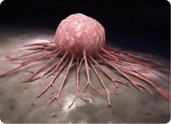 e-Xpert VVT: Oncologie