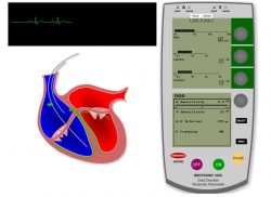 e-Xpert: Pacemakers