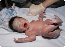 e-Xpert: Newborn Life Support (L-NL G-NL21)