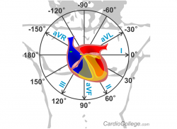 e-Xpert ECG: Beoordelen van ritmes