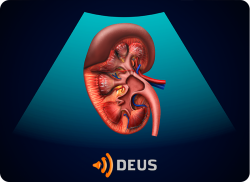 e-Xpert DEUS Echografie: Nieren