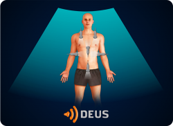 e-Xpert DEUS Echografie: eFAST