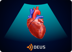 e-Xpert DEUS Echografie: Point-of-care echocardiografie