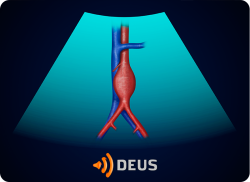 e-Xpert DEUS Echografie: Abdominale aorta