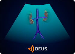 e-Xpert DEUS Echografie: Vena cava inferior