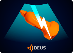 e-Xpert DEUS Echografie: Shock