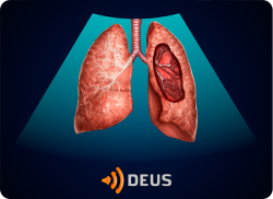 e-Xpert DEUS Echografie: Longen