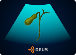 e-Xpert DEUS Echografie: Galblaas
