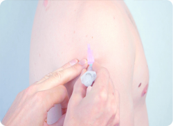 e-Xpert VBH: Intramusculair injecteren