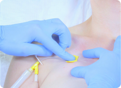 e-Xpert VBH: Vleugelnaald en insuflon