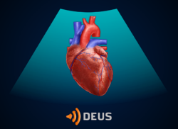 e-Xpert DEUS kind: Point-of-care echografie circulatoir falen bij kinderen (KNMG-GAIA)