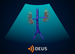 e-Xpert DEUS: Vena cava inferior (KNMG-GAIA)