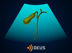 e-Xpert DEUS: Galblaas (KNMG-GAIA)