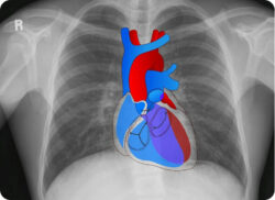 e-Xpert: Beoordelen X-thorax (KNMG-GAIA)