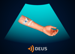 e-Xpert DEUS: Echogeleide perifere intraveneuze vaattoegang (KNMG-GAIA)