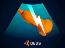 e-Xpert DEUS: Shock (KNMG-GAIA)