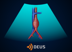 e-Xpert DEUS: Abdominale aorta (KNMG-GAIA)