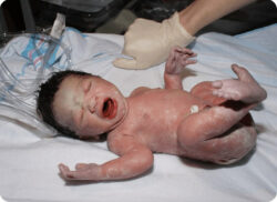 e-Xpert: Newborn Life Support (KNMG-GAIA)