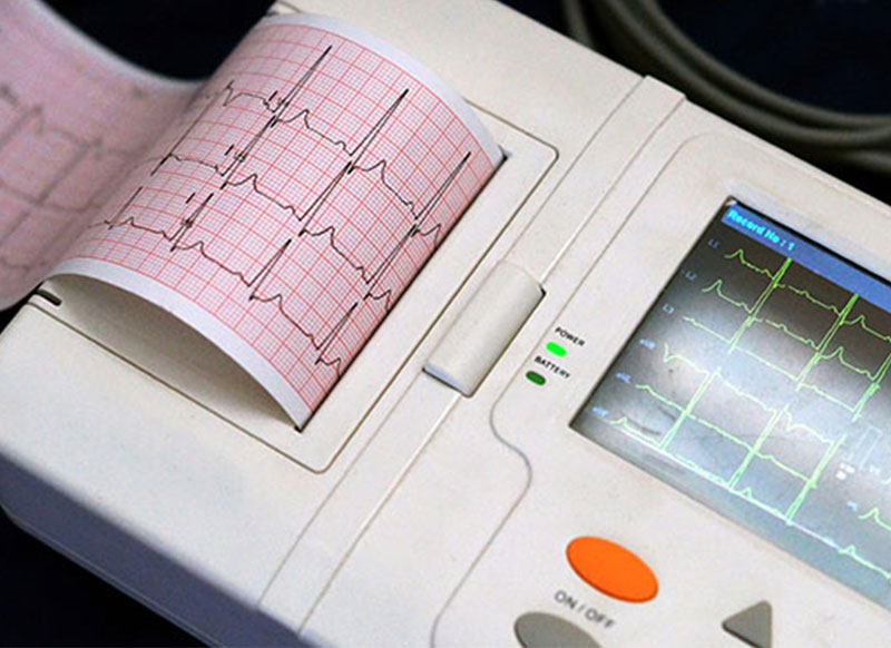e-Xpert: ECG maken